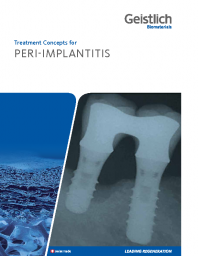 Treatment concepts for peri-implantitis