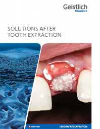Solutions after tooth extraction